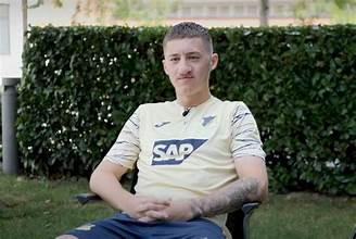 Angelo Stiller Hasenscharte